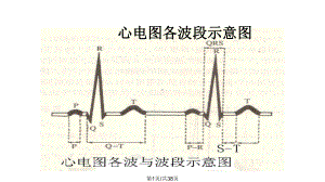 常见心电图分析课件.pptx