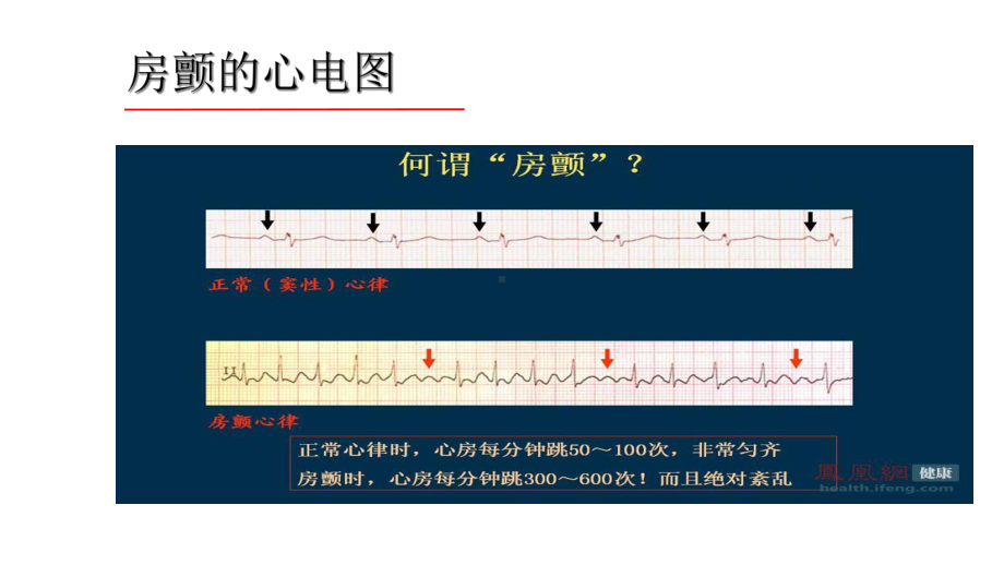 房颤抗凝出血评估-课件.ppt_第3页