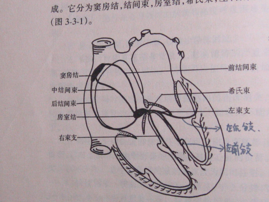 常见心电图诊断课件.ppt_第2页