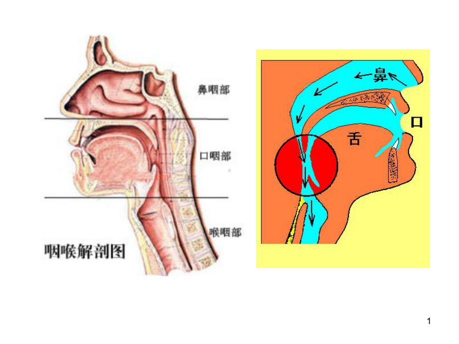 咽炎病人的护理-课件.ppt_第1页