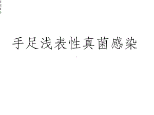 手足浅表性真菌感染课件.ppt