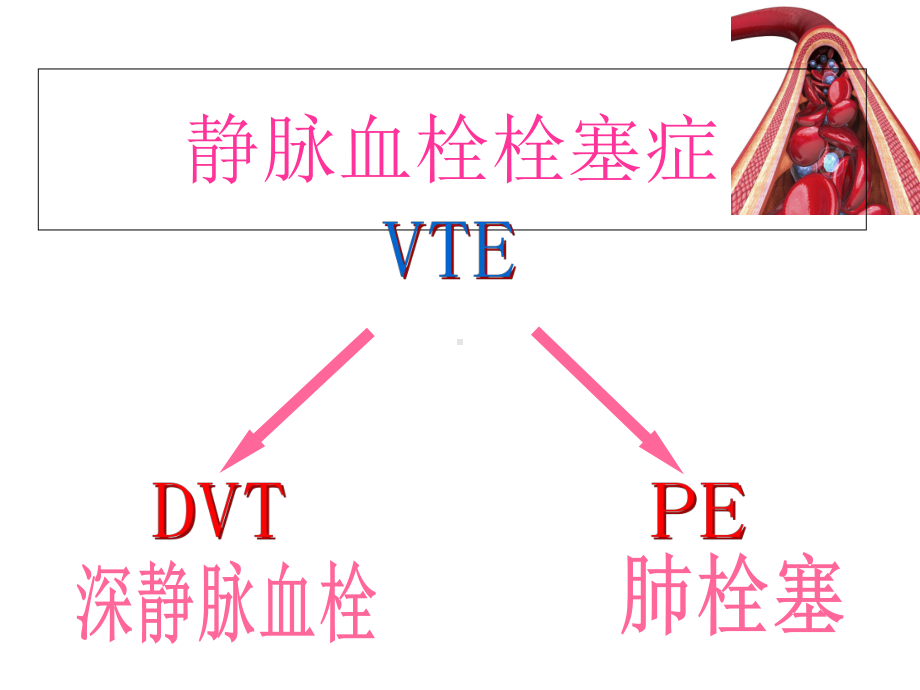 危重症患者深静脉血栓治疗预防及护理-课件.ppt_第2页