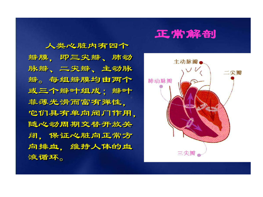 主动脉瓣狭窄术后护理共24张课件.ppt_第3页