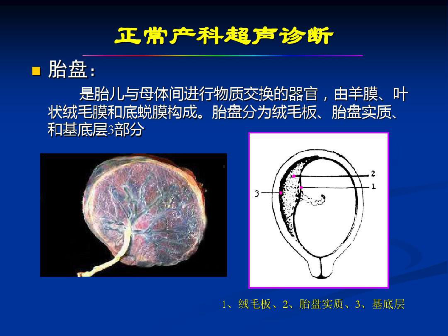 产科急诊超声诊断共39张课件.ppt_第2页