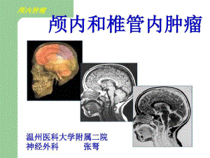 （外科学课件）颅内肿瘤及颅内椎管肿瘤血管性疾病共94页.ppt