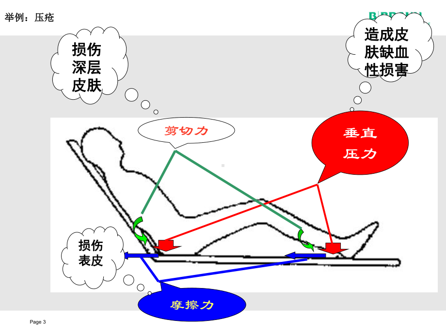 伤口及伤口治疗的生理病理知识课件.ppt_第3页