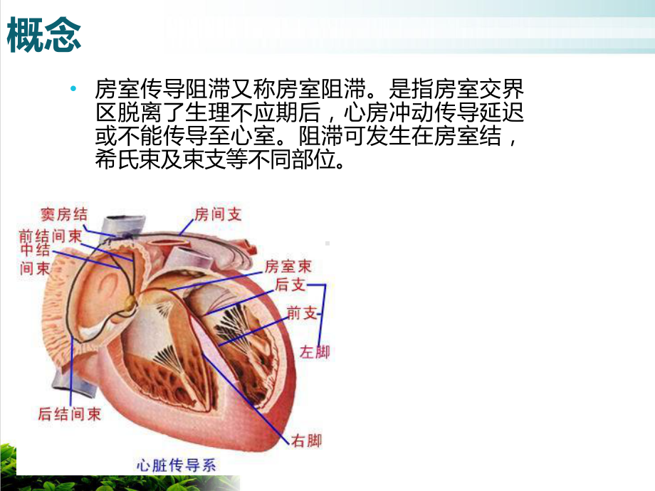 三度房室传导阻滞护理查房重改课件.ppt_第3页