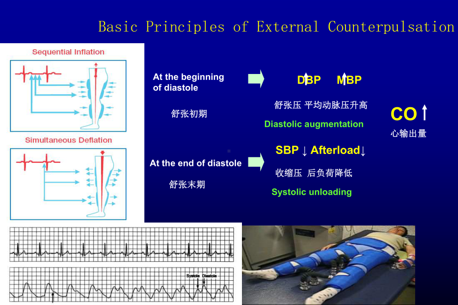 体外反搏对脑循环血流动力学的改变-leung英课件.ppt_第3页