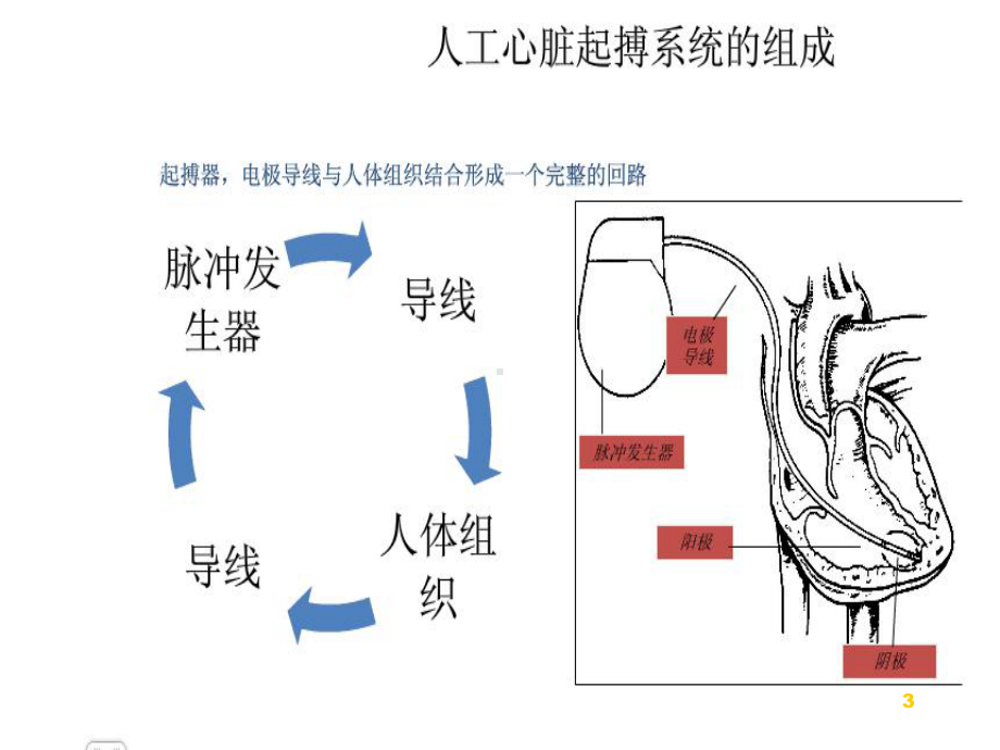 人工心脏起搏器植入术的护理课件.ppt_第3页