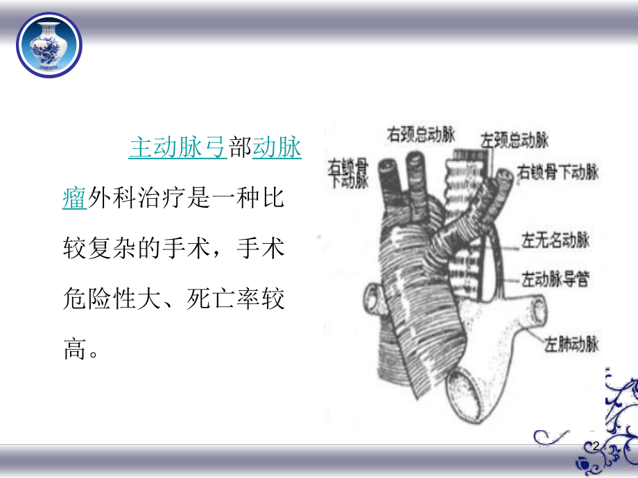 主动脉置换术课件.ppt_第2页