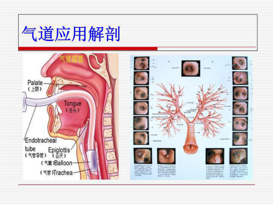 人工气道患者的护理共34张课件.ppt_第3页