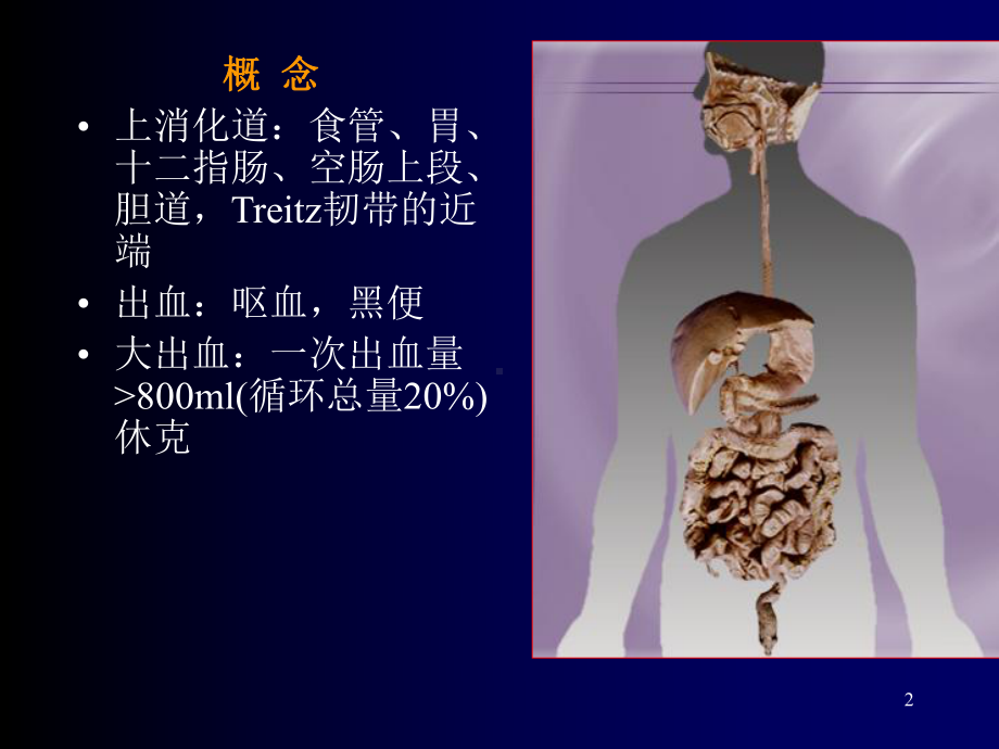 上消化道大出血课件-2.ppt_第2页