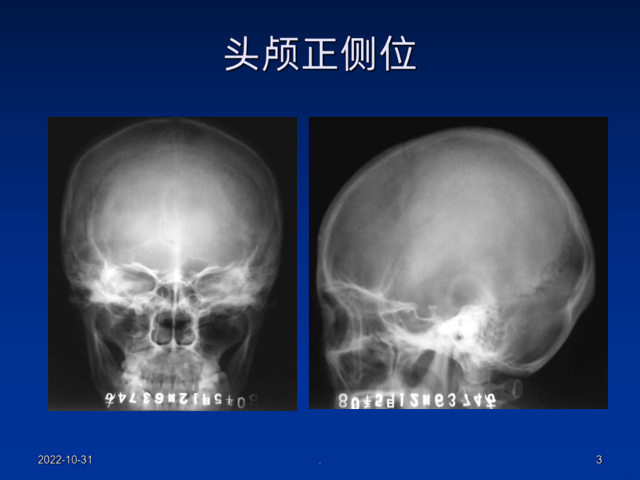 中枢神经系统疾病精讲课件.ppt_第3页