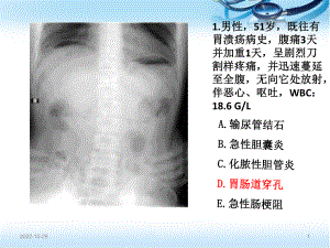 住院医师规陪出科考试辅助检查(课堂)课件.ppt