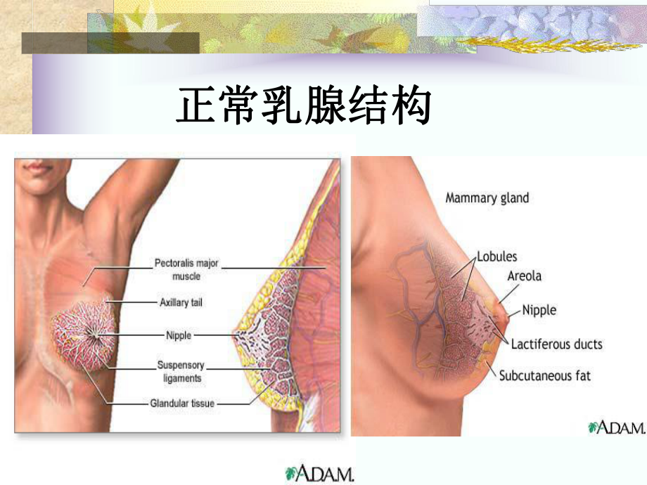 乳腺钙化的X线鉴别诊断课件.ppt_第2页