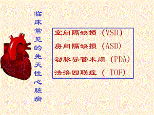 临床常见的先天性心脏病共60张课件.ppt