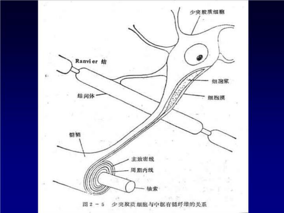 中枢神经系统脱髓鞘病共44张课件.ppt_第3页