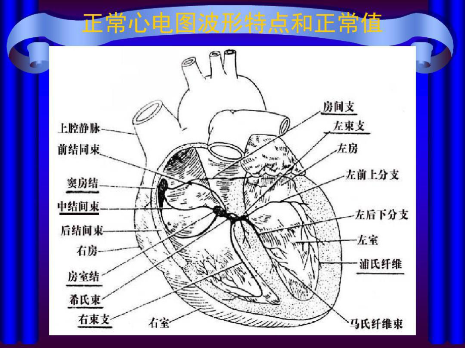 业务学习心律失常共25张课件.ppt_第3页