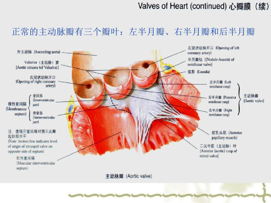 主动脉瓣置换术后的护理41张课件.ppt_第2页