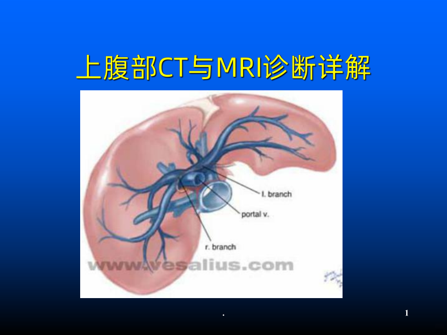 上腹部CT与磁共振课件.ppt_第1页