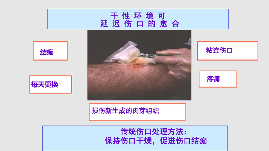 伤口敷料课件.pptx_第3页