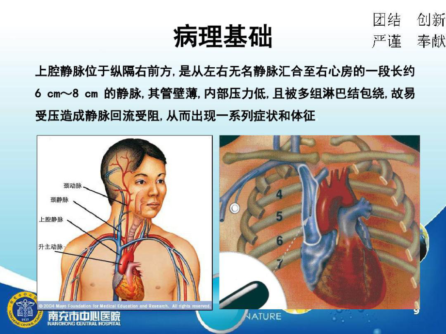 上腔静脉综合征护理查房44张课件.ppt_第3页