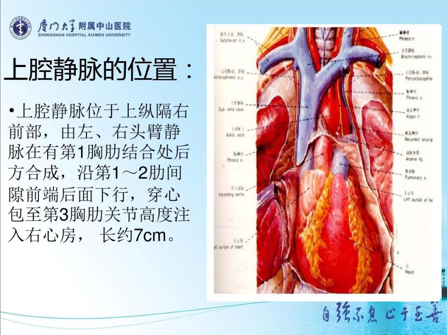 上腔静脉阻塞综合征共21张课件.ppt_第3页