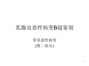 乳腺良恶性病变B超鉴别课件.ppt