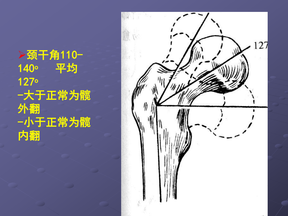 下肢骨折与脱位课件.ppt_第3页