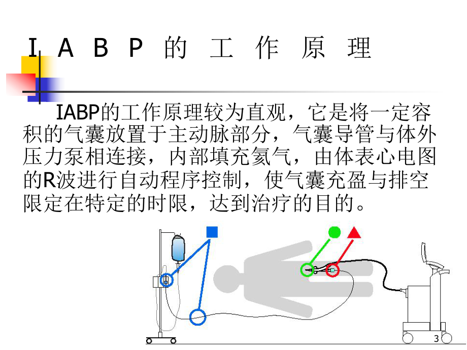 主动脉内球囊反搏(IABP)的临床应用课件.ppt_第3页