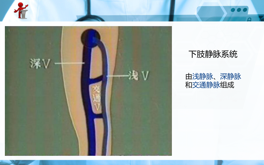 原发性下肢静脉曲张病人的护理课件.ppt_第2页