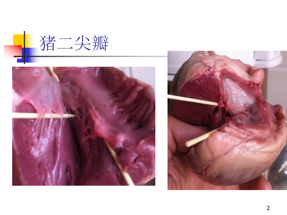 心脏瓣膜病内科学第8版第二篇课件.pptx_第2页