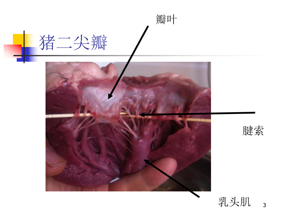 心脏瓣膜病内科学第8版第二篇课件.pptx_第3页