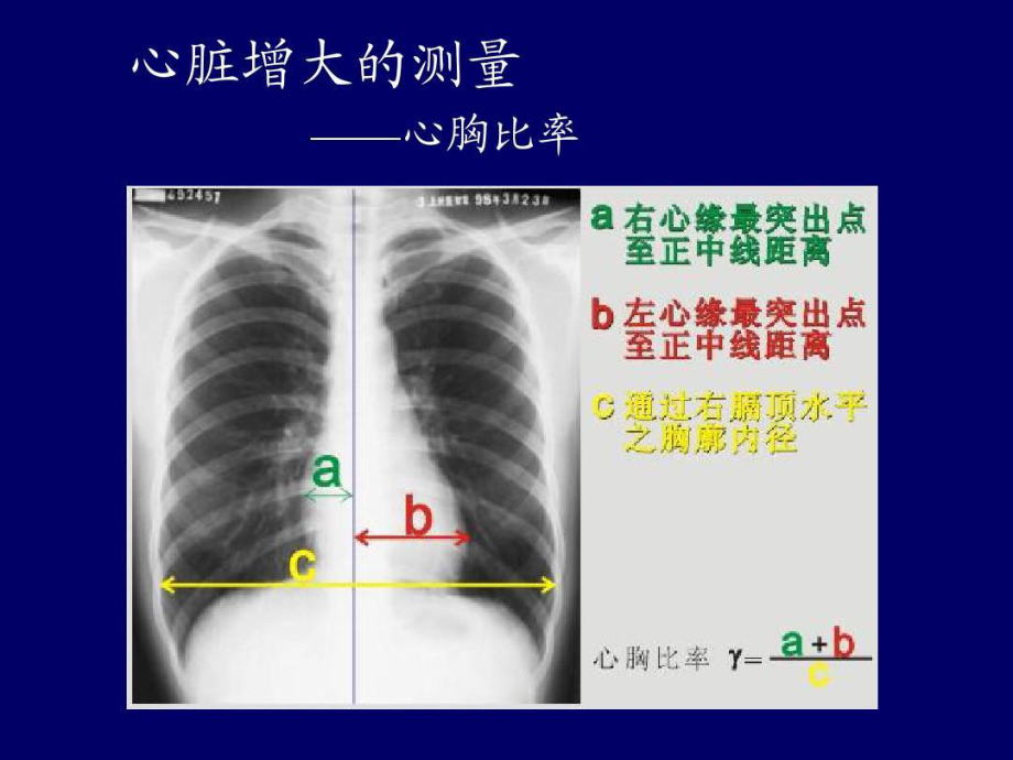 心血管疾病影像学诊断共64张课件.ppt_第2页