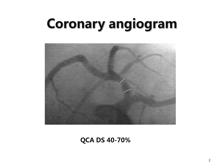 冠状动脉内影像学及功能评价课件.ppt_第2页