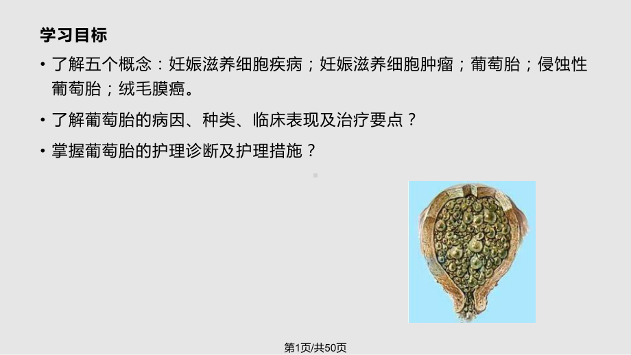 妇科疾病查房葡萄胎课件.pptx_第1页