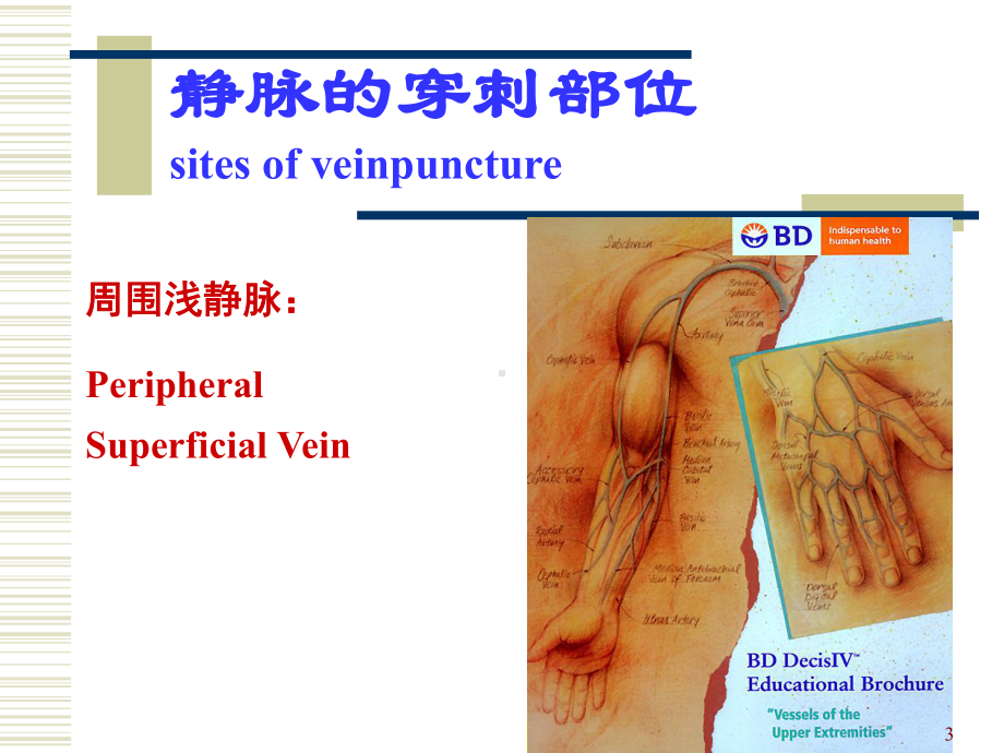 常见输液故障及排除方法医学课件.ppt_第3页