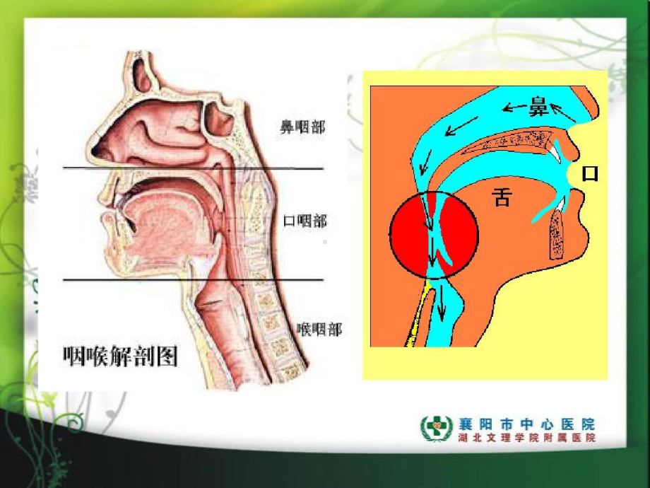 咽炎病人的护理共23张课件.ppt_第2页