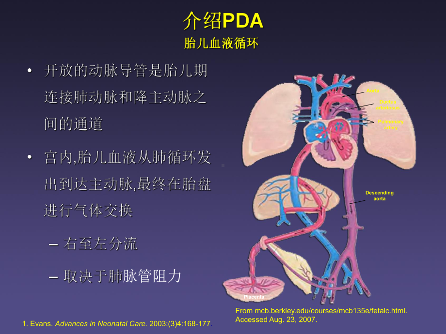 动脉导管未闭(PDA)治还是不治课件.ppt_第3页