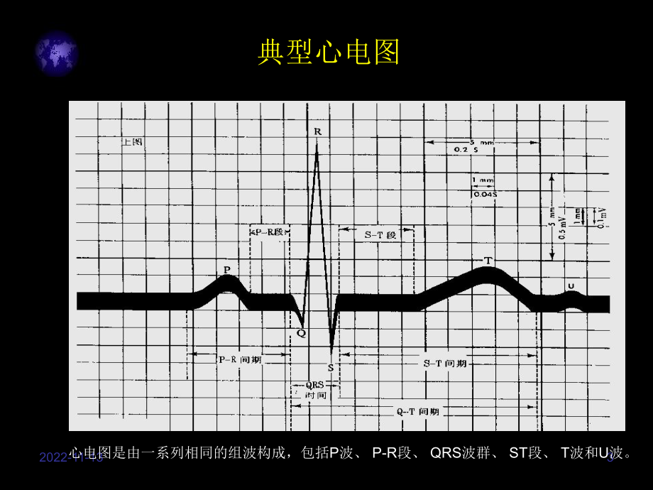 心电图入门zhidao课件.ppt_第3页