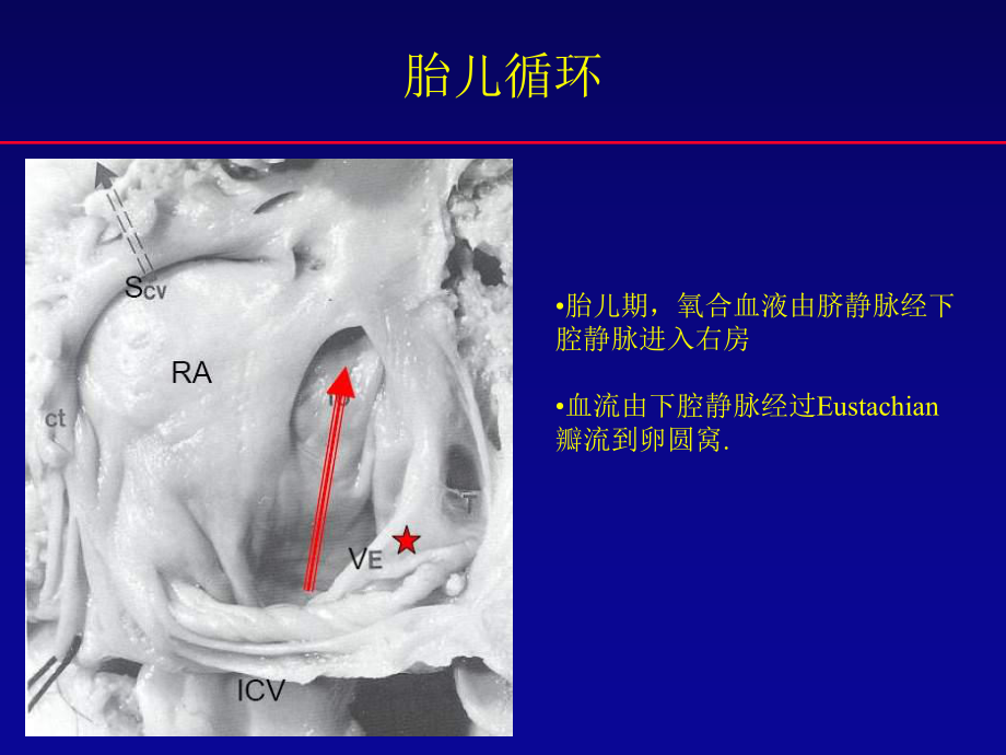 卵圆孔未闭封堵术：争论与发展(中英文)课件.ppt_第2页