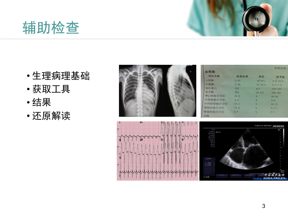 心电图基础解析课件.ppt_第3页