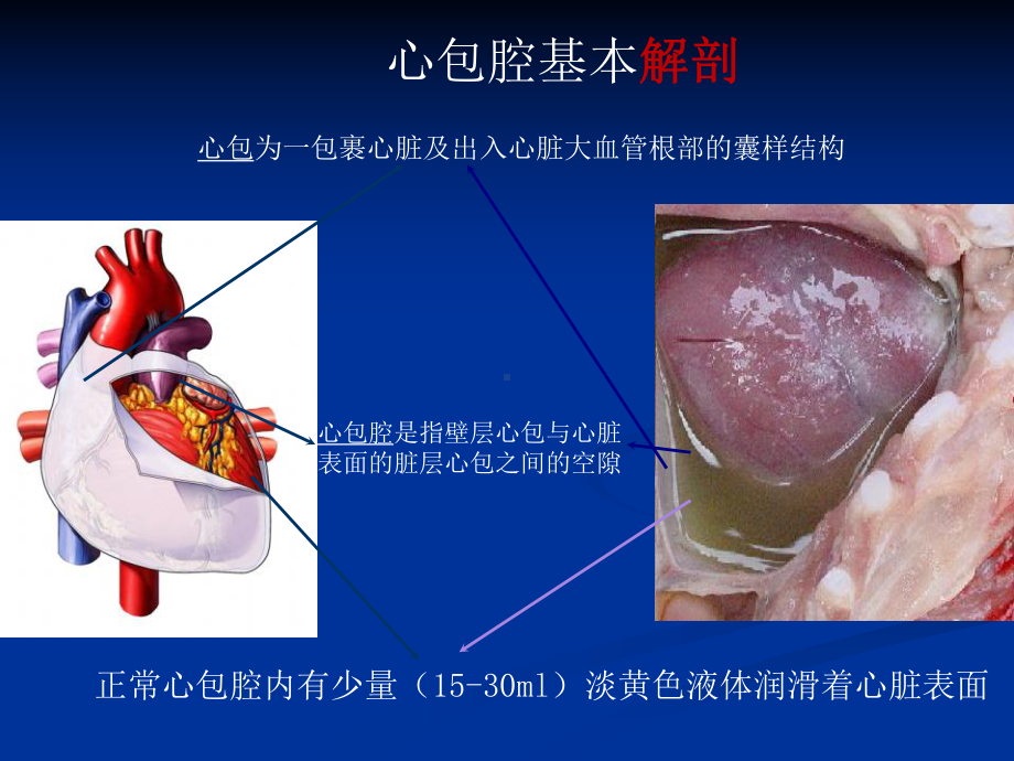 心包填塞正式版课件.ppt_第2页