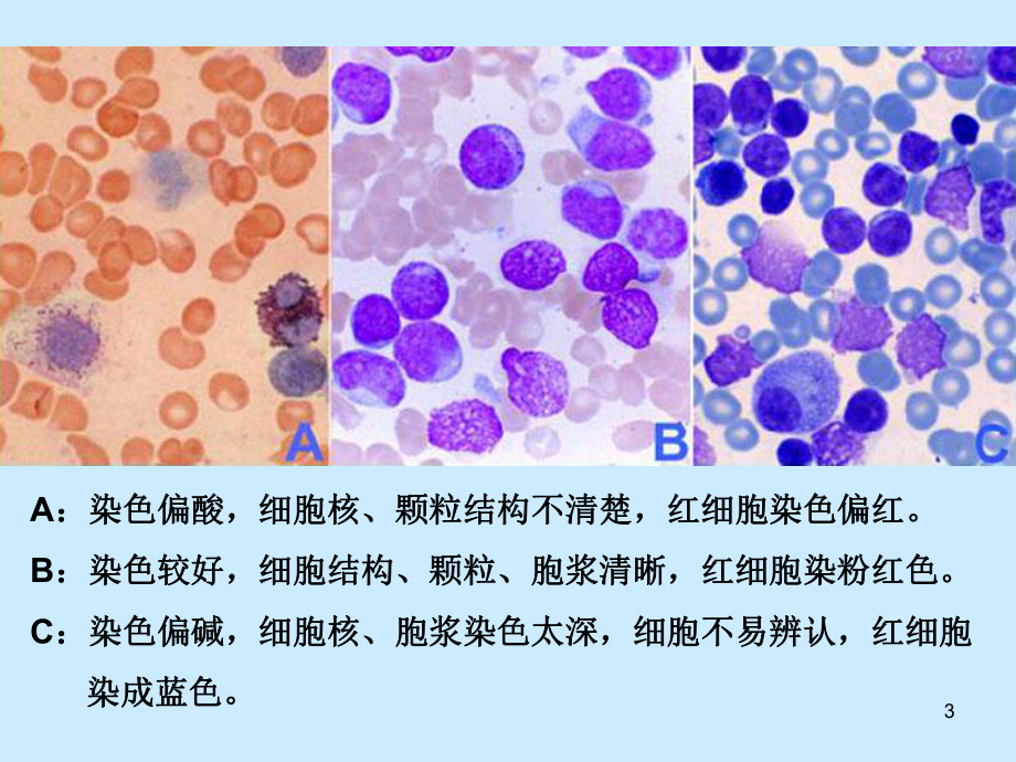 外周血细胞形态的观察课件-2.pptx_第3页