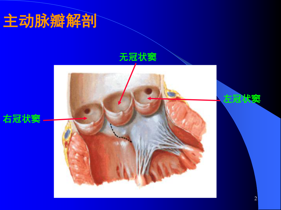 心内科教学主动脉狭窄及关闭不全课件.ppt_第2页