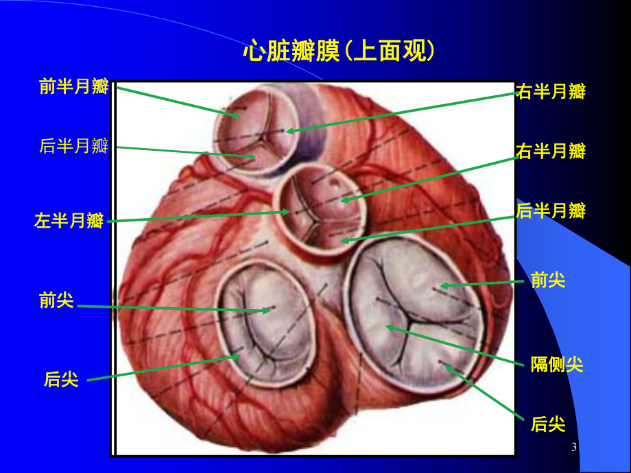 心内科教学主动脉狭窄及关闭不全课件.ppt_第3页