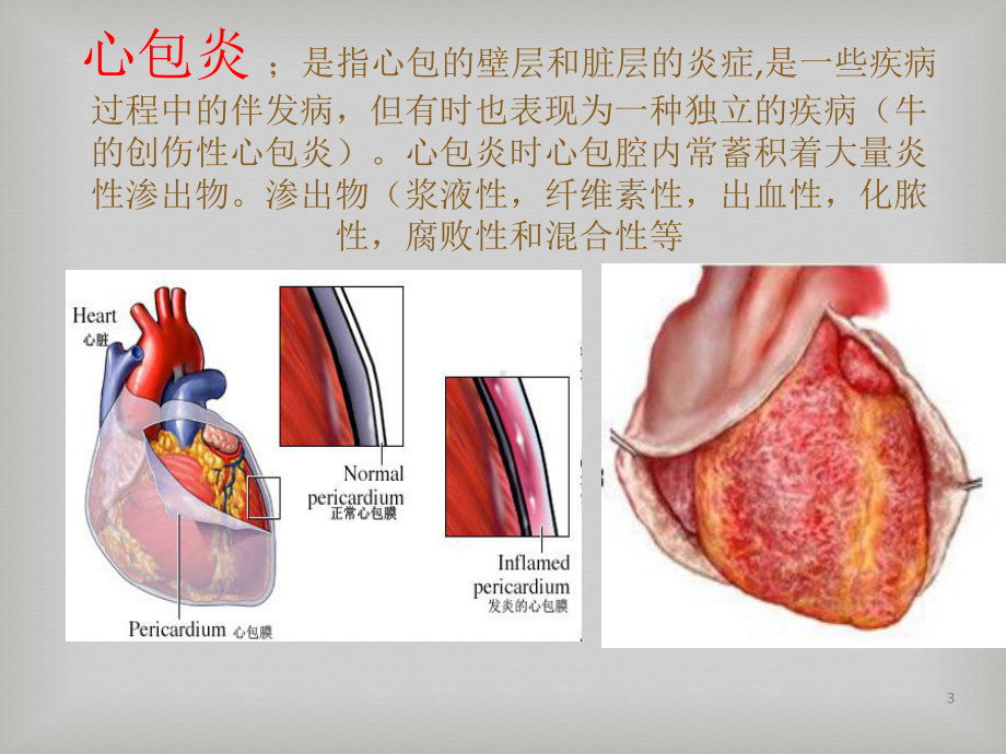 心脏和造血系统病理-课件.ppt_第3页