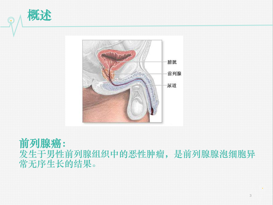 心电前列腺腹腔镜手术后的护理课件.ppt_第3页