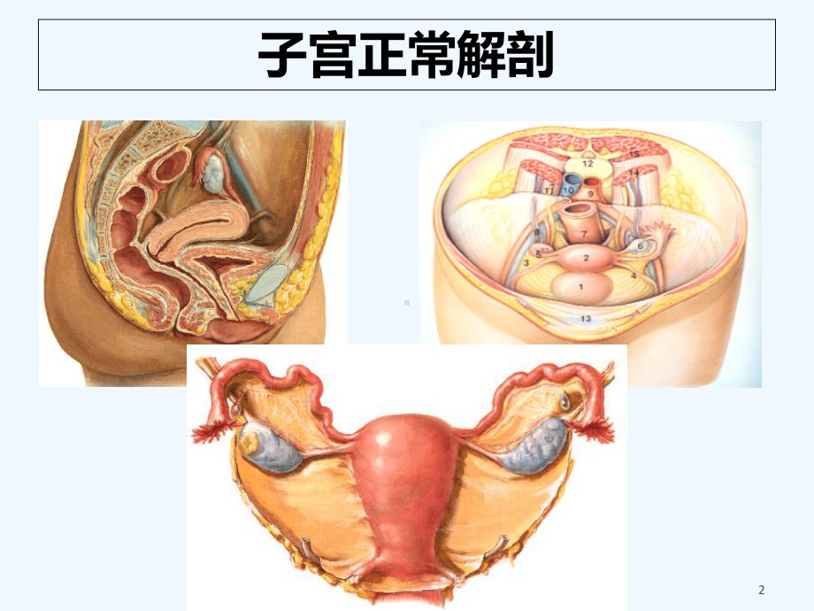 子宫肌层病变-课件.ppt_第2页