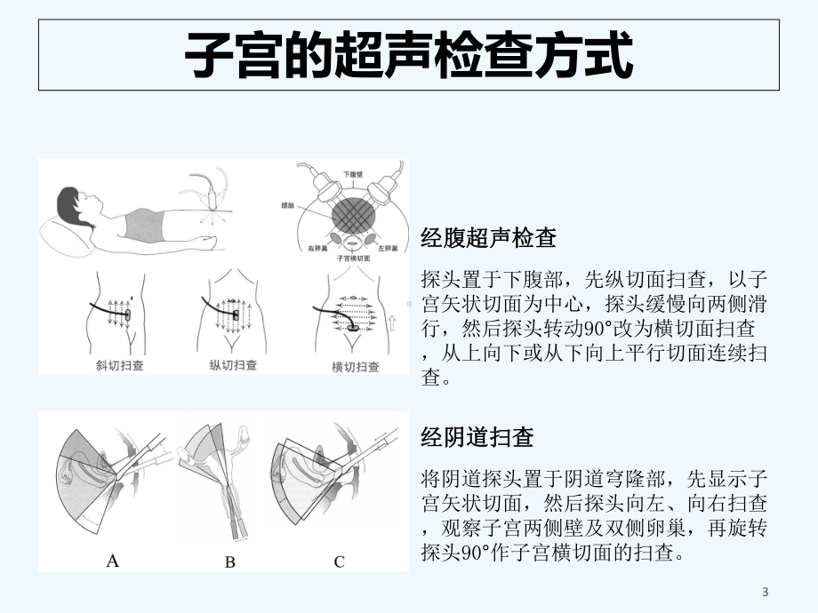 子宫肌层病变-课件.ppt_第3页